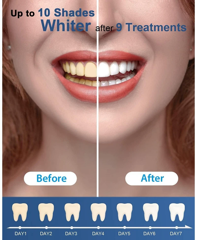 MySmile Teeth Whitening Gel Pen Refill Pack, 3 Non-Sensitive Teeth Whitening Pen, Deluxe Teeth Whitener Dental Grade Tooth Whitening Gel with Carbamid