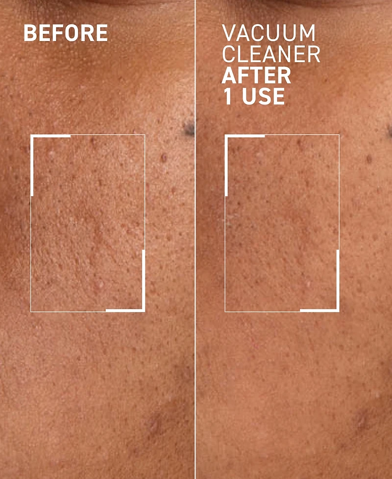dr. brandt Pores No More Vacuum Cleaner Pore Purifying Mask, 1-oz.