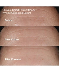 Clinique 4-Pc. Wrinkle-Fighting Routine Skin Care Set