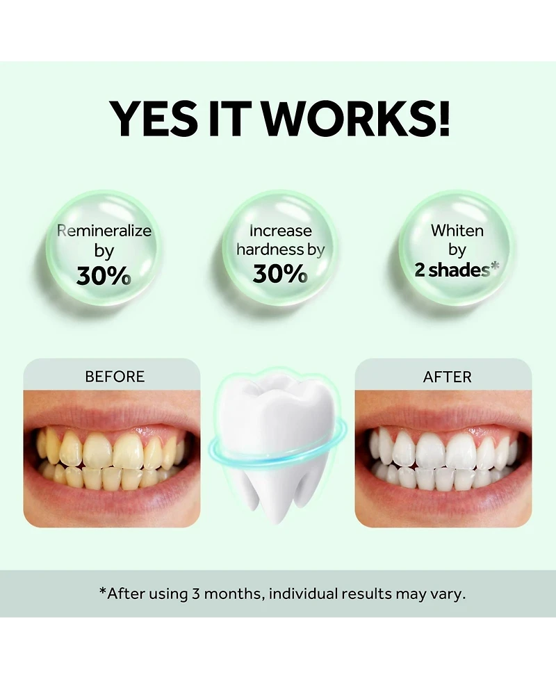 MySmile Nano-Hydroxyapatite Toothpaste for Sensitive Teeth