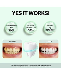 MySmile Nano-Hydroxyapatite Toothpaste for Sensitive Teeth