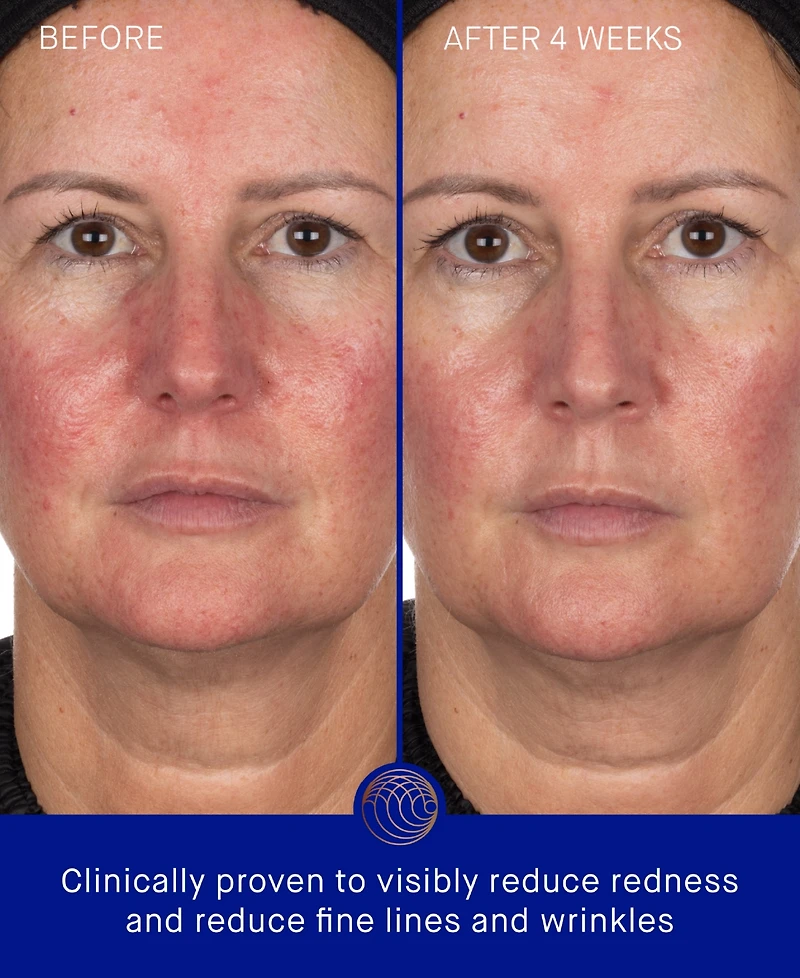 Augustinus Bader The Hydrogel Face Mask, 3-Pack