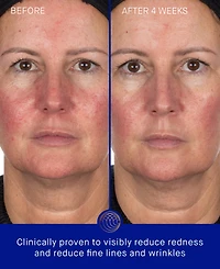 Augustinus Bader The Hydrogel Face Mask, 3-Pack