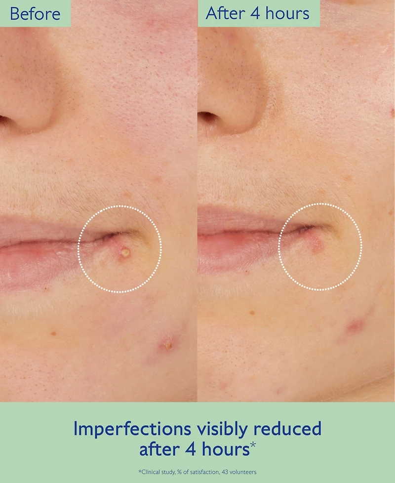 Caudalie Vinopure Salicylic Acid Targeted Spot Solution, 0.5 oz.