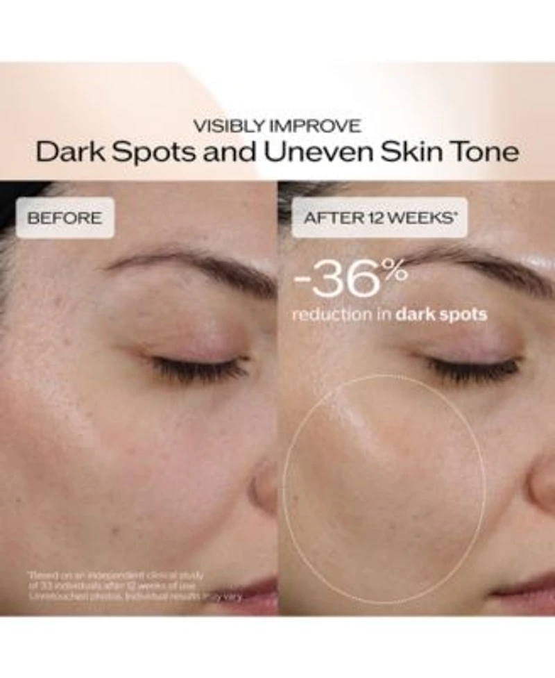 Shiseido Benefiance Brightening Dark Spot Wrinkle Smoothing Serum