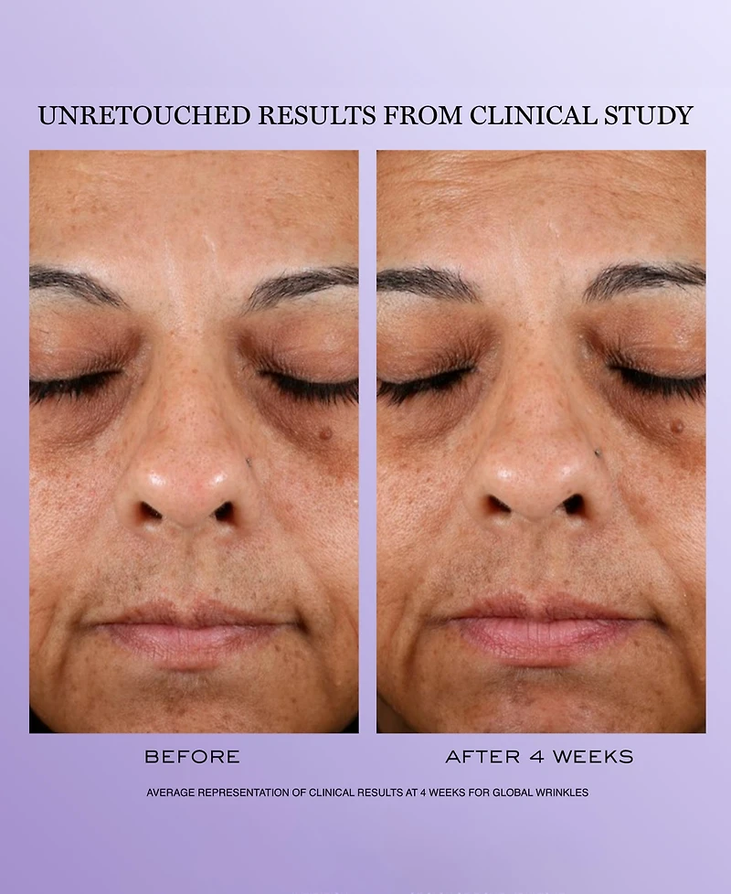 Lancome 3-Pc. Renergie Mother's Day Skincare Set