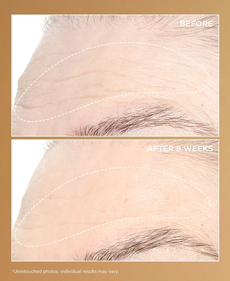 Perricone Md Neuropeptide Pro-Strength Firming Moisturizer, 2 oz.