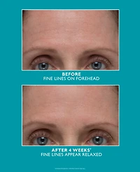 Peter Thomas Roth Peptide Skinjection Amplified Wrinkle-Fix Serum, 1 oz