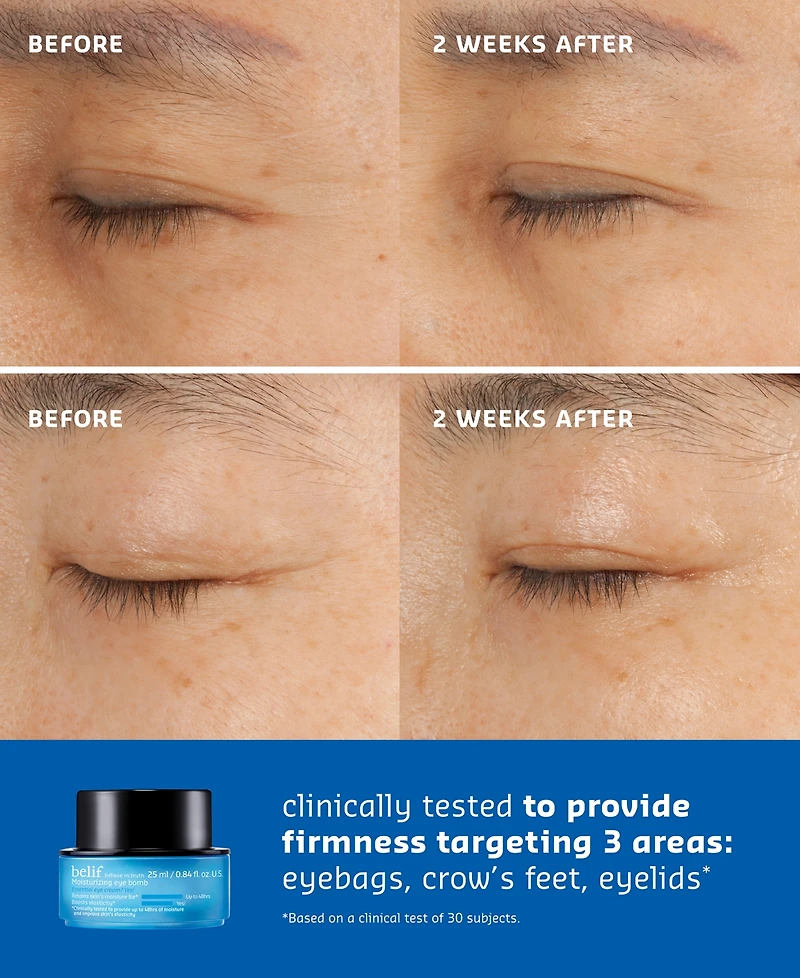 Belif Moisturizing Eye Bomb With Peptide, Ceramide & Squalane, 0.84 oz.