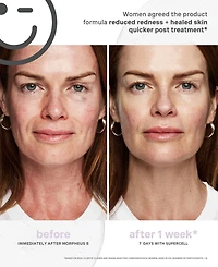 Kate Somerville KateCeuticals SuperCell Rejuvenation Serum, 1 oz.
