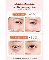 TOUCHBeauty Anti Wrinkle Hot Cool Facial Device