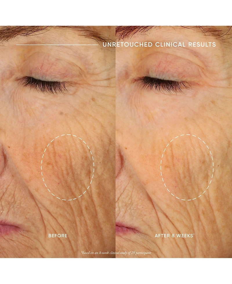 philosophy Ultimate Miracle Worker Nourish & Rejuvenate Face & Neck Cream