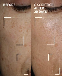 Dr. Brandt C Scription Brightening Serum, 1 oz.