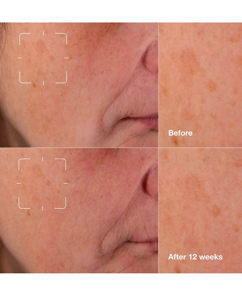 Clinique Even Better Clinical Dark Spot Clearing Serum with Vitamin C