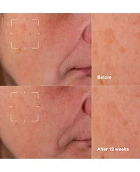 Clinique Even Better Clinical Dark Spot Clearing Serum with Vitamin C