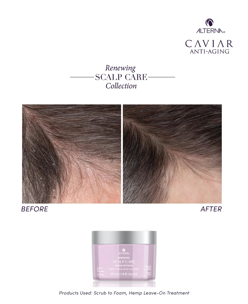 Alterna Renewing Scalp Care Scrub To Foam, 6 oz.