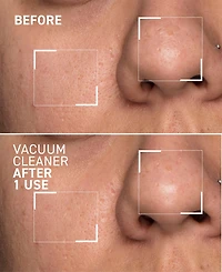 dr. brandt Pores No More Vacuum Cleaner Pore Purifying Mask, 1-oz.
