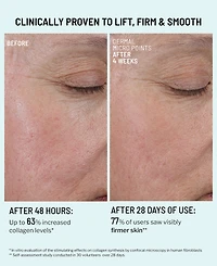 Dr. Brandt Dermal Micro Points Collagen Boosting Gel, 1 oz.