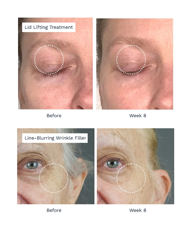 City Beauty Lift Lifting Treatment and Line Blurring Wrinkle Cream