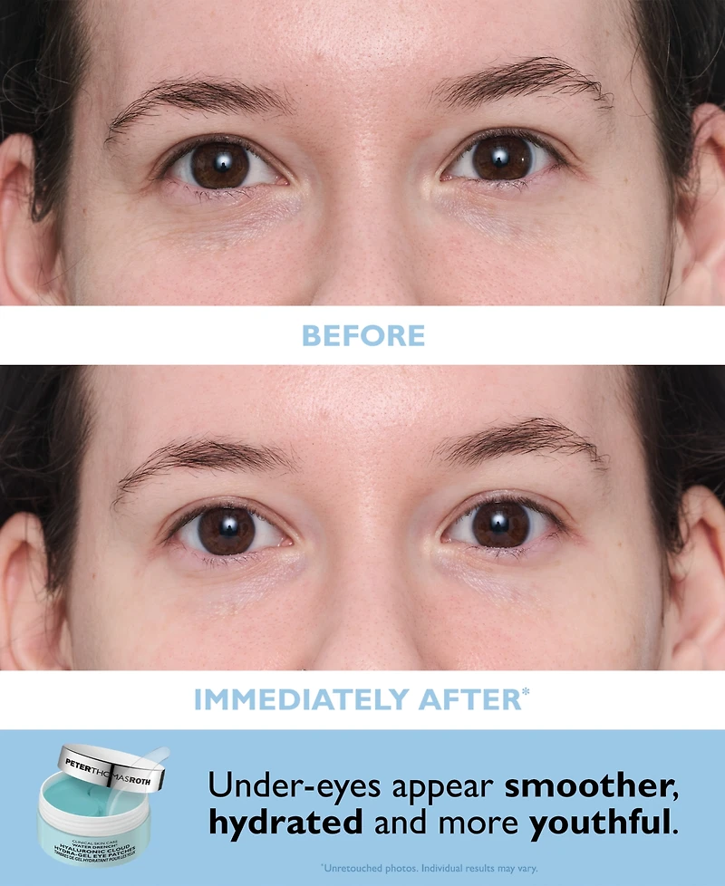 Peter Thomas Roth 2-Pc. Vitamin C and Hyaluronic Eye Patches Set