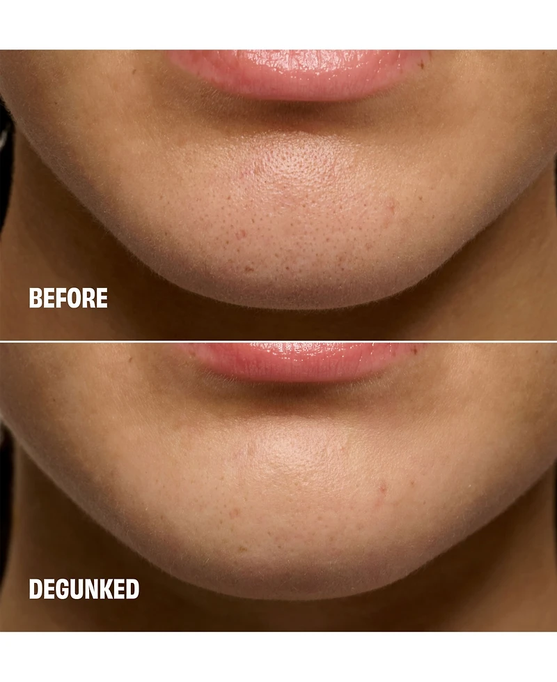 Benefit Cosmetics The POREfessional Degunker Blackhead and Pore Cleansing Mask System