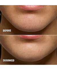 Benefit Cosmetics The POREfessional Degunker Blackhead and Pore Cleansing Mask System