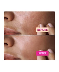 Makari Niacinamide Facial Cleansing Bar - 7oz