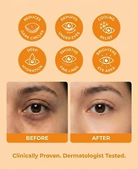 Lovery 4-Step Korean Eye Balm Collection - Korean Skin Care Complete Under-Eye Renewal Set
