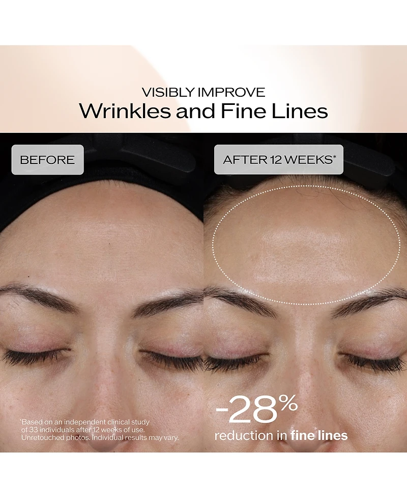 Shiseido 4-Piece Benefiance Brightening & Smoothing Serum Set