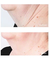 Perricone Md Cold Plasma Plus+ Sub-d/Neck
