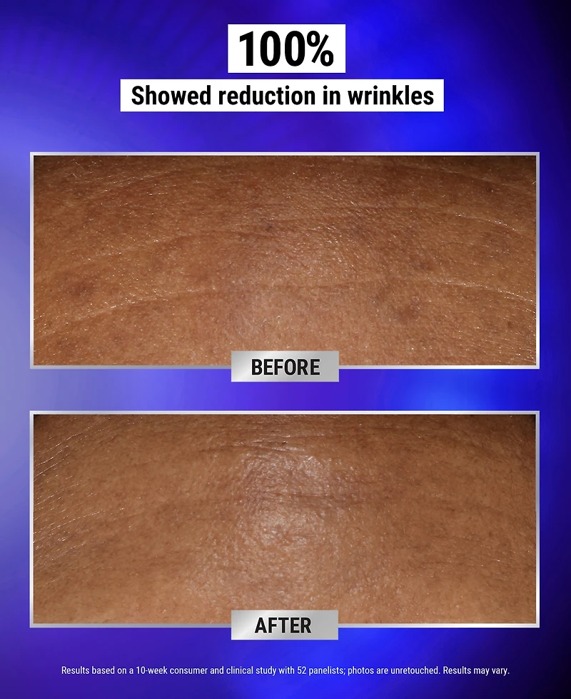 Kiehl's Since 1851 Retinol Fast Release Wrinkle-Reducing Night Serum, 0.94 oz.
