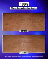 Kiehl's Since 1851 Retinol Fast Release Wrinkle-Reducing Night Serum, 0.94 oz.