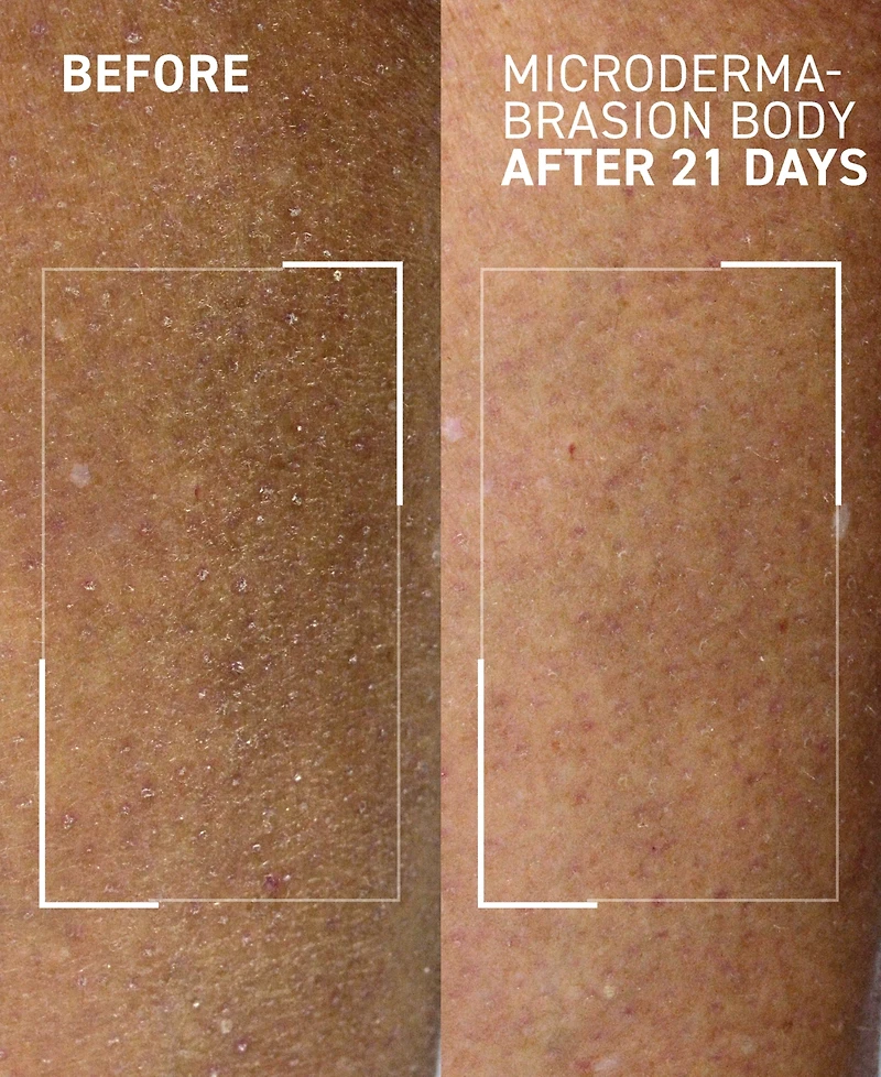 Dr. Brandt Microdermabrasion Hydrating Body Exfoliator, 3.5 oz.