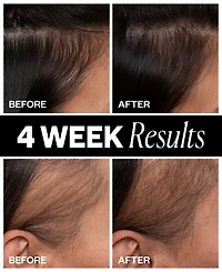 Igk Hair Sponsored Hair Density Scalp Treatment, 2.1 oz.