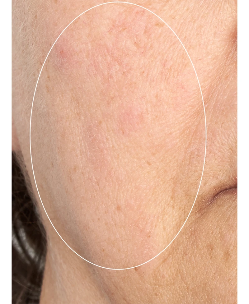 Perricone Md Hp Intensive Smoothing Serum, 2.0 oz