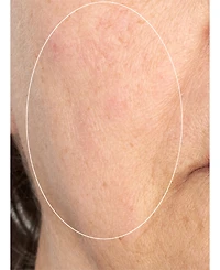 Perricone Md Hp Intensive Smoothing Serum, 2.0 oz