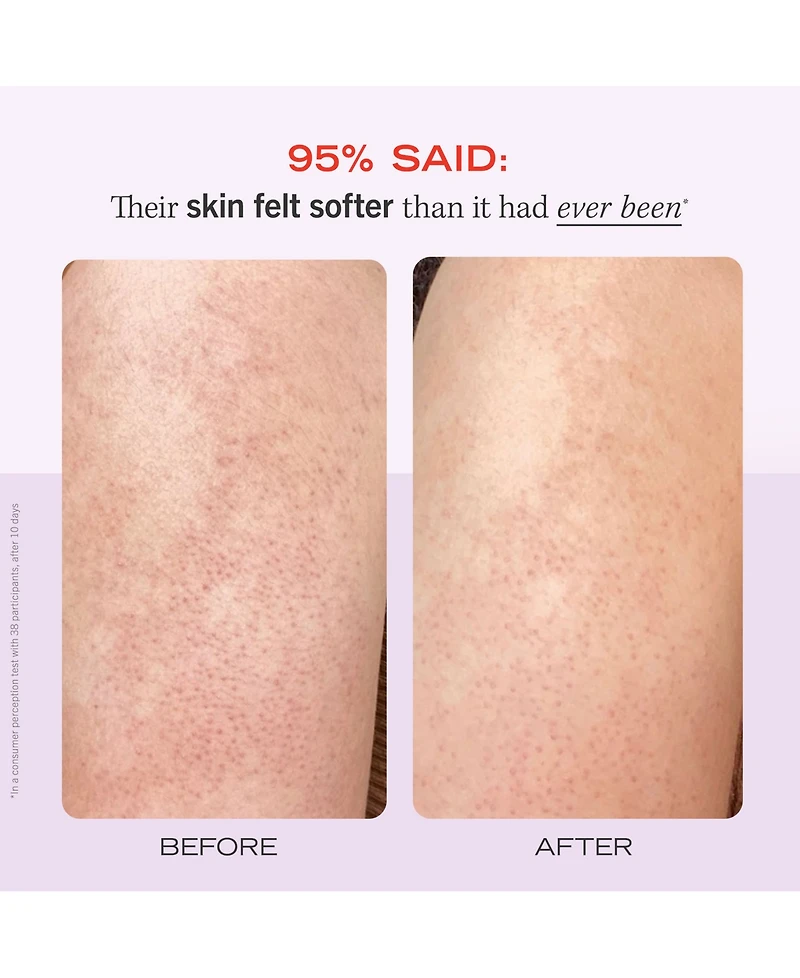 First Aid Beauty Kp Bump Eraser Body Scrub With 10% Aha