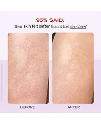 First Aid Beauty Kp Bump Eraser Body Scrub With 10% Aha