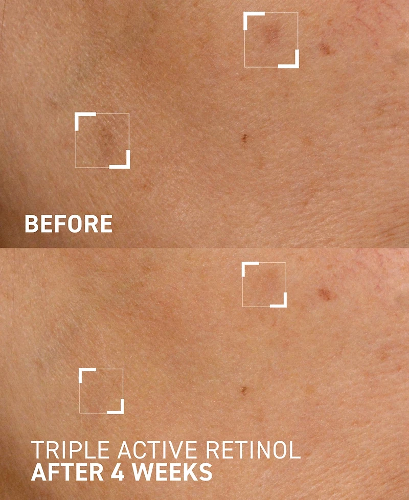 Dr. Brandt Triple Active Retinol Gentle Overnight Renewal Cream, 1 oz.