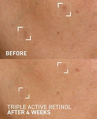 Dr. Brandt Triple Active Retinol Gentle Overnight Renewal Cream, 1 oz.