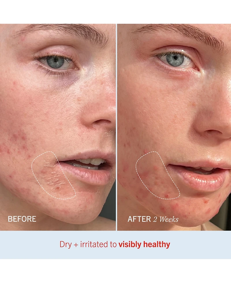 First Aid Beauty Ultra Repair Cream