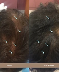 Ds Laboratories Spectral.dnc-n Hair Density Serum With Nanoxidil 5%, 3-Month Supply