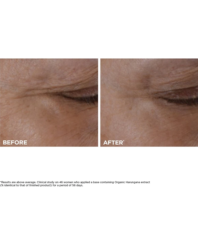 Clarins Total Eye Lift Eye Cream, 0.5 oz.