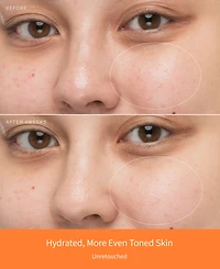Sulwhasoo 4-Pc. First Care Activating Serum Vi Set