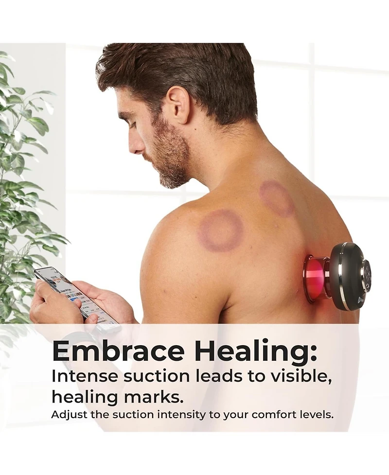 LifePro 4-in-1 Smart Cupping Therapy Massager - Portable Rechargeable Device for Muscle Relief, Skin Firming & Recovery