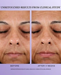 Lancome 3-Pc. Renergie H.c.f. Triple Serum Discovery Set