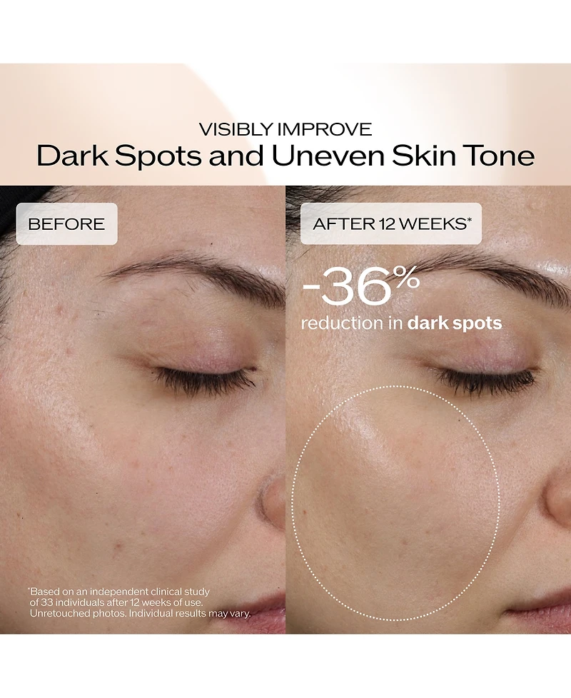 Shiseido Benefiance Dark Spot and Wrinkle Smoothing Serum, 1.6 oz.