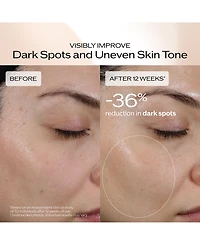 Shiseido Benefiance Dark Spot and Wrinkle Smoothing Serum, 1.6 oz.