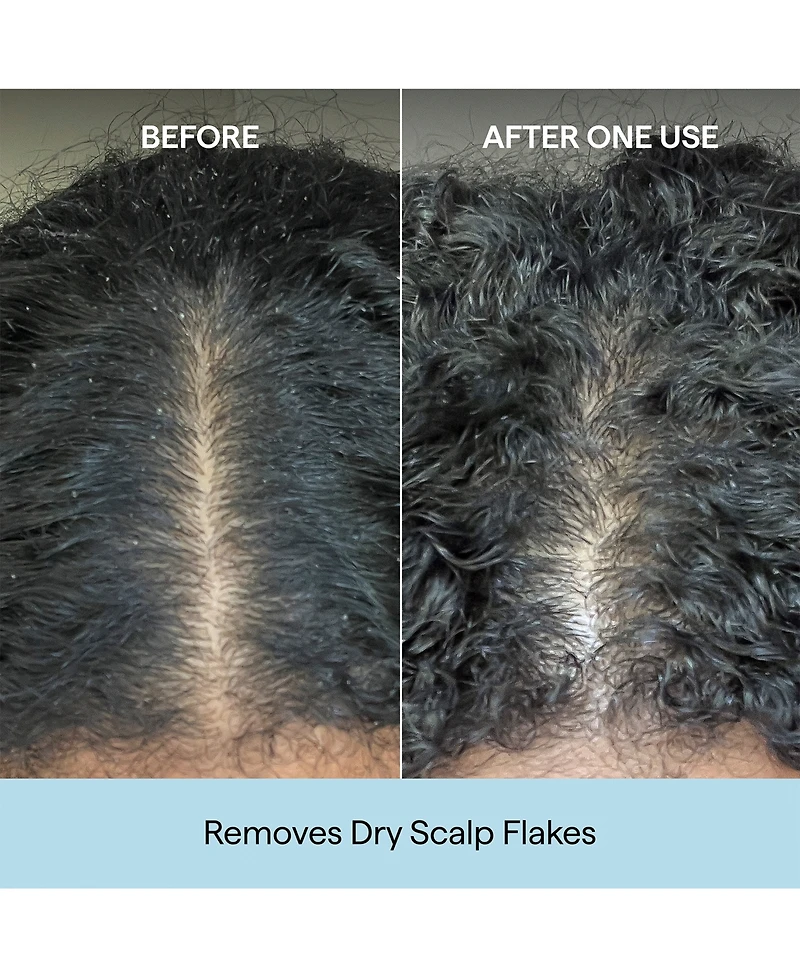 Briogeo Scalp Revival Charcoal + Coconut Oil Micro-Exfoliating Shampoo Jumbo, 32 oz.