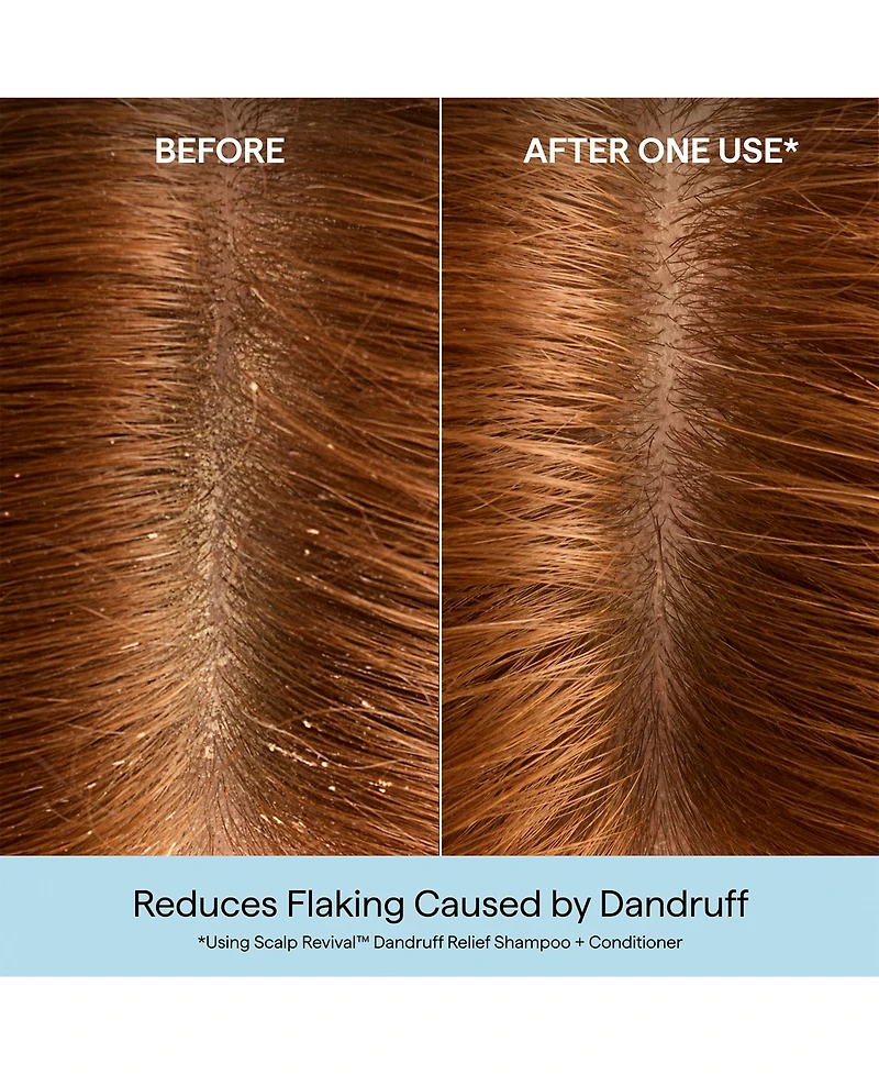 Briogeo Scalp Revival Dandruff Shampoo, 8.4 oz.